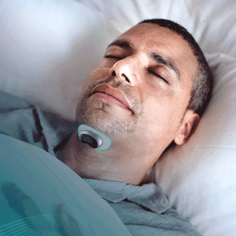 Drugega Kroga Mišični Stimulator Spanje Apnea Monitor CPAP Replacer Biosensor z APP