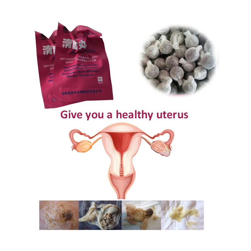 Lepo Življenje Brisa tamponi Yoni biseri Pripomočki Žensk ginekologija Vagina Detox Tampon potiskalo Kitajski odvajanje toksinov